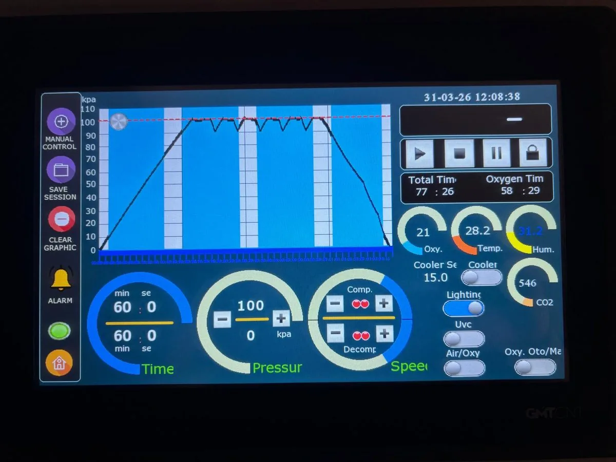 Chamber controller showing the pressure profile with automated air breaks